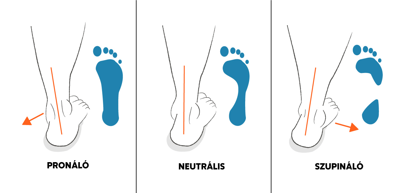 Lábállás típusok – pronáló, neutrális, szupináló